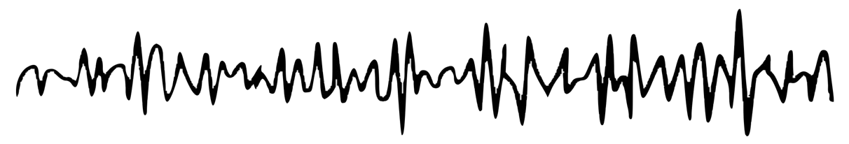 Gamma waveform pattern