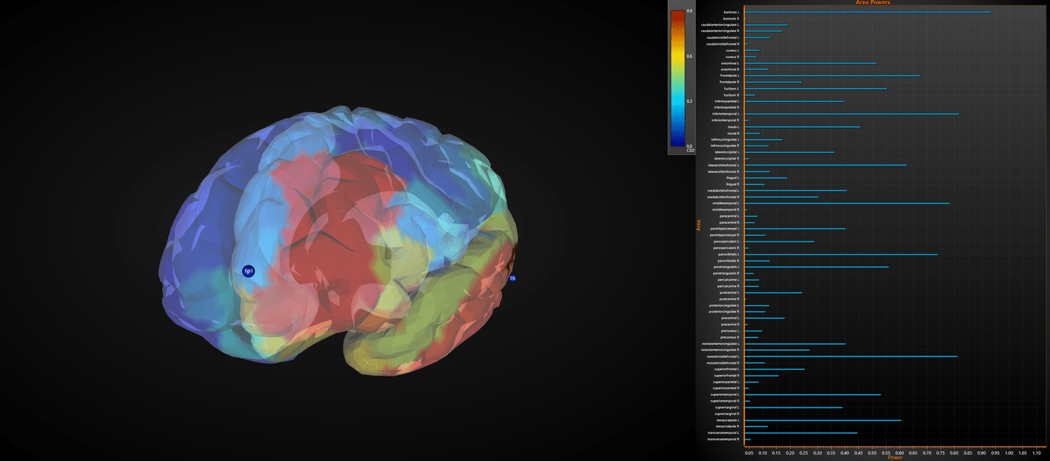 3D brain visualization showing network connectivity