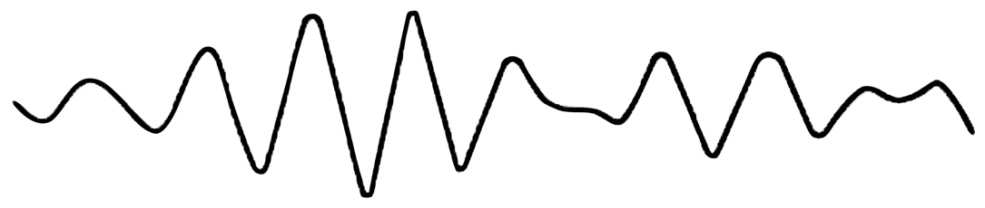 Alpha waveform pattern