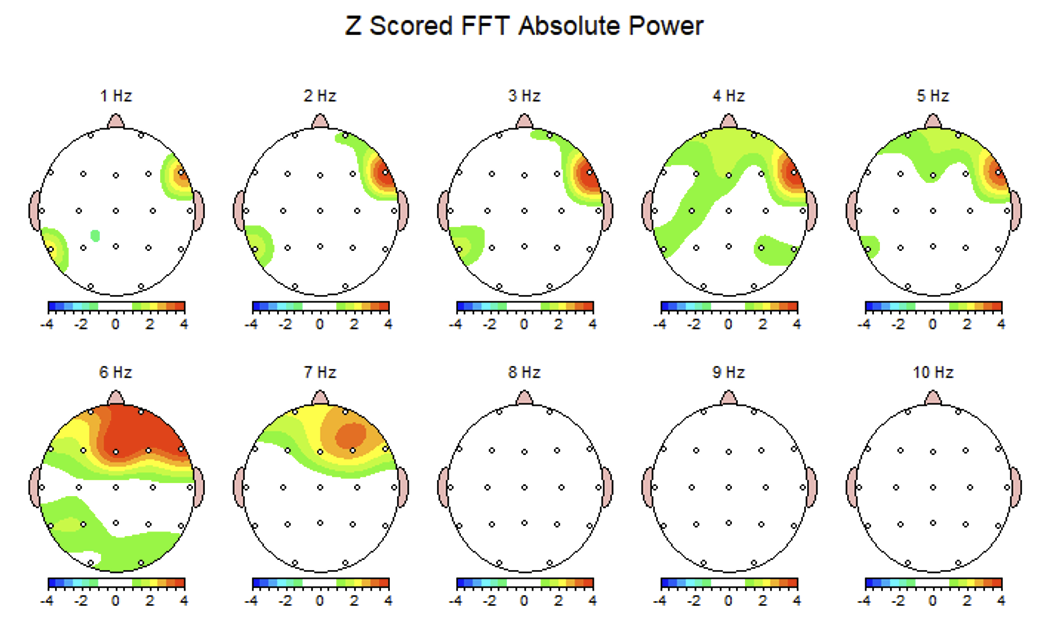 Z-Scored FFT Power