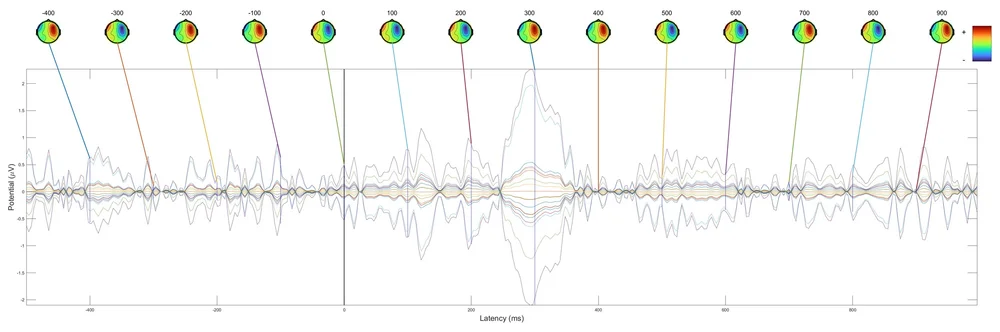 ERP Analysis