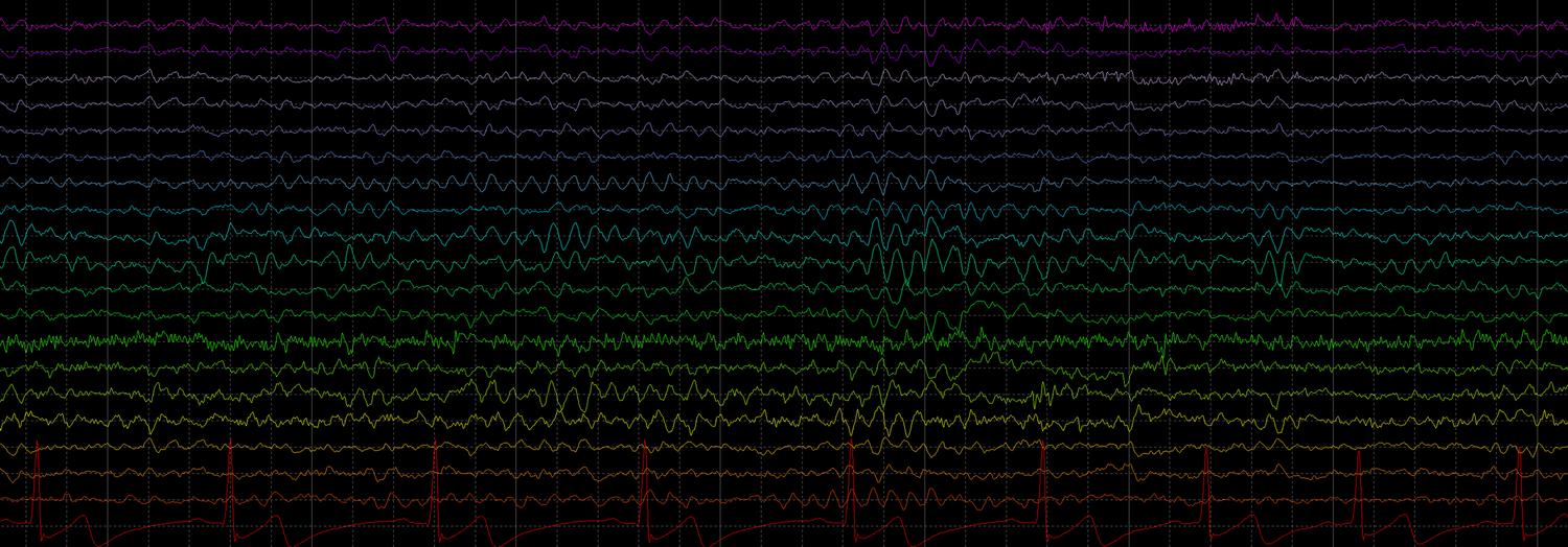 Raw EEG Recording